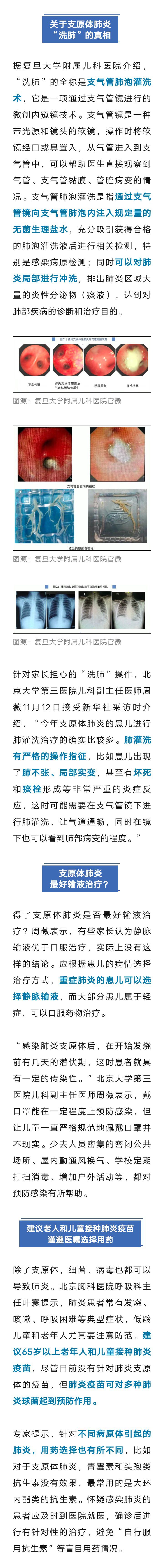 7岁男童肺部实变！有医院一天最高峰67例“洗肺”……7983 作者:峰华花园 帖子ID:262115 男童,肺部,医院,一天,最高